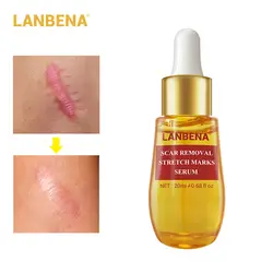 LANBENA Acne лечебная сыворотка лицо экстракт для лица анти Удаление Шрама от акне крем для ухода за кожей Отбеливающий Восстанавливающий Прыщ