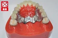 

Crown teeth model standard sleeve detachable tooth model