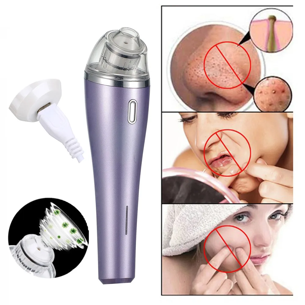 ABS Blackhead Vacuum Acne Cleaner Pore Remover Electric Skin Facial