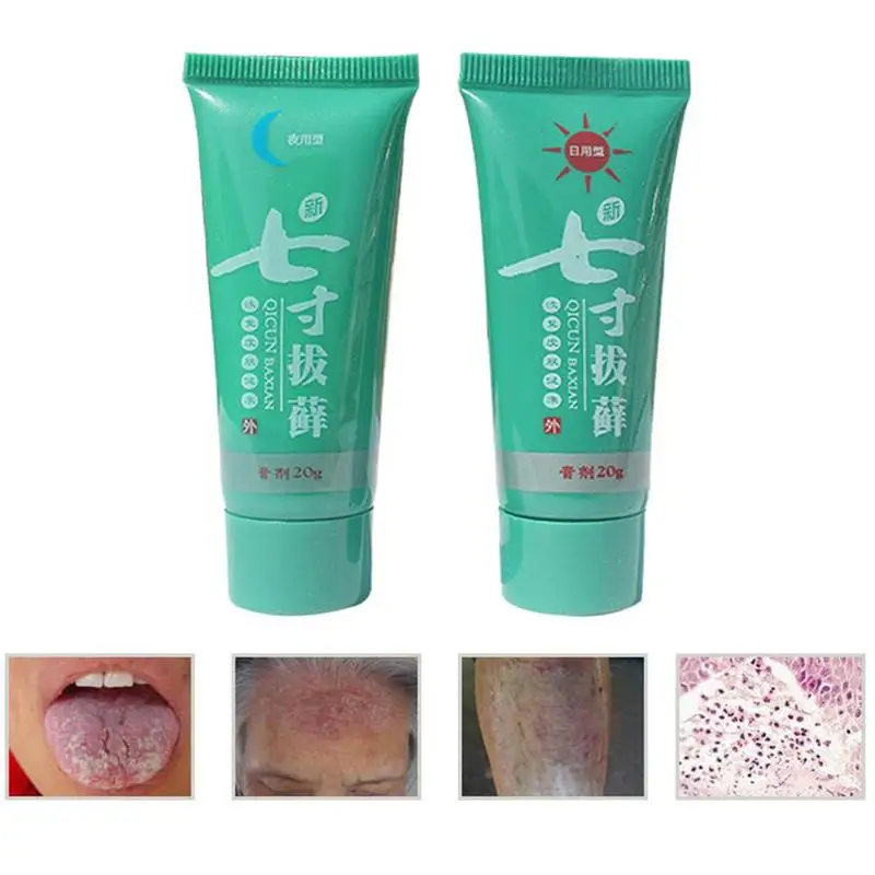 1 Set Day & Night Body Psoriasis Cream Dermatitis Eczematoid Eczema Ointment Skin Psoriasis Treatment