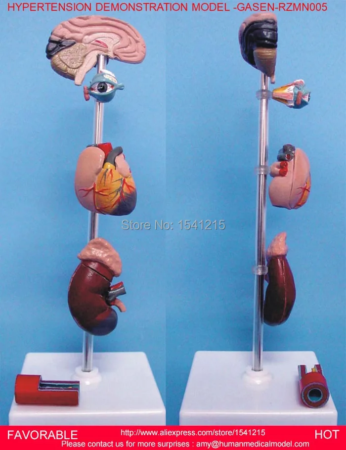 

HUMAN ORGAN WITH BRAIN HEART KIDNEY MODEL,ANTOMY MEDICAL ORGANS MODEL,HYPERTENSION DEMONSTRATION MODEL -GASEN-RZMN005