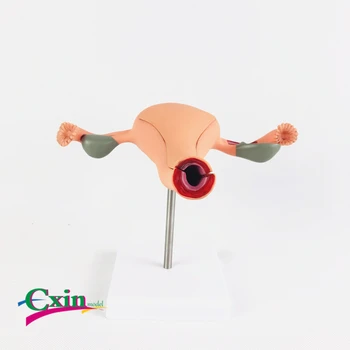 

Human normal uterus model gynecological medical education model reproductive anatomy medical teaching