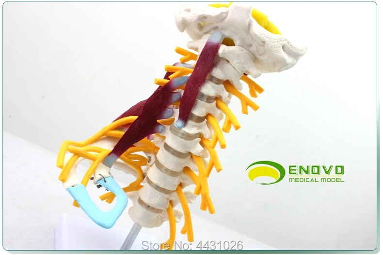 Модель человеческого костного образца в брахиальном сплетении мышечной модели шейного отдела позвоночника человека