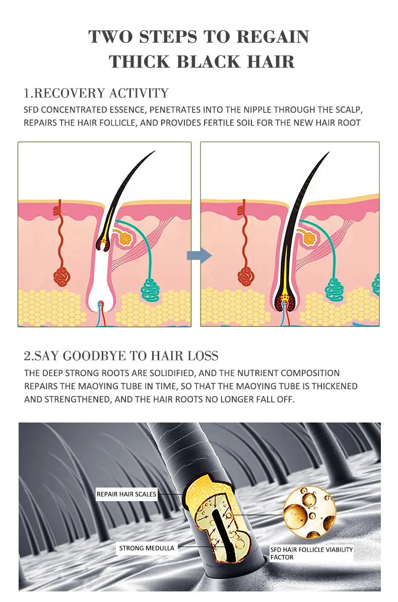 Hair Growth Development Essence Anti-hair loss Hair Care Deep Nourishment Hair Conditioner Essential oil 30ml