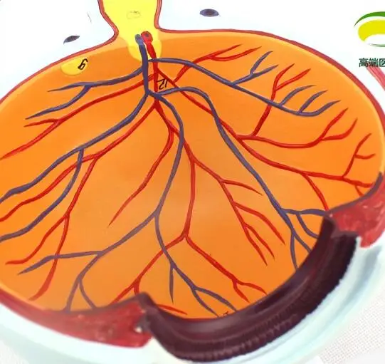 Анатомия глаза человека модель Анатомия глаза отделение офтальмология Учебная модель