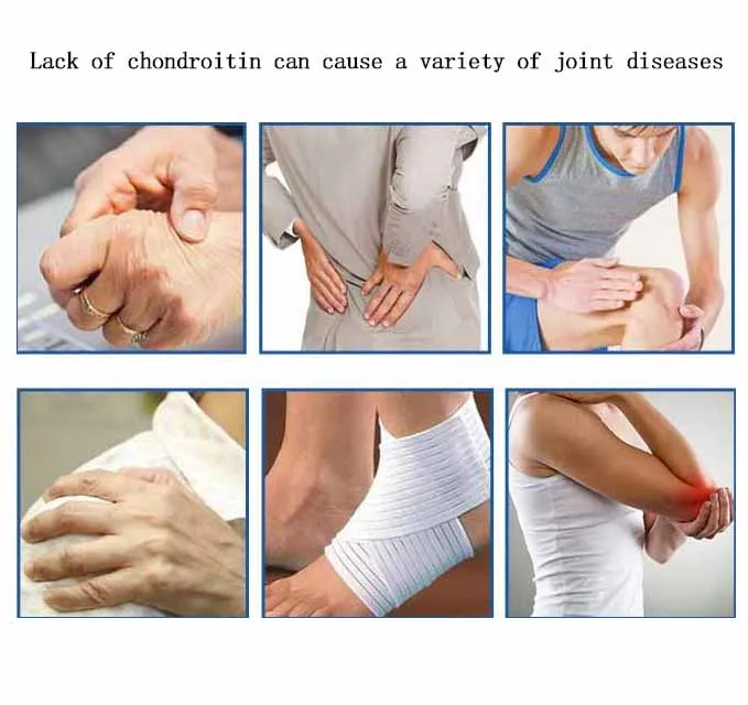 Glucosamine Chondroitin Protective Joint For Old People Increase Bone Density Relieve pain Bone Care