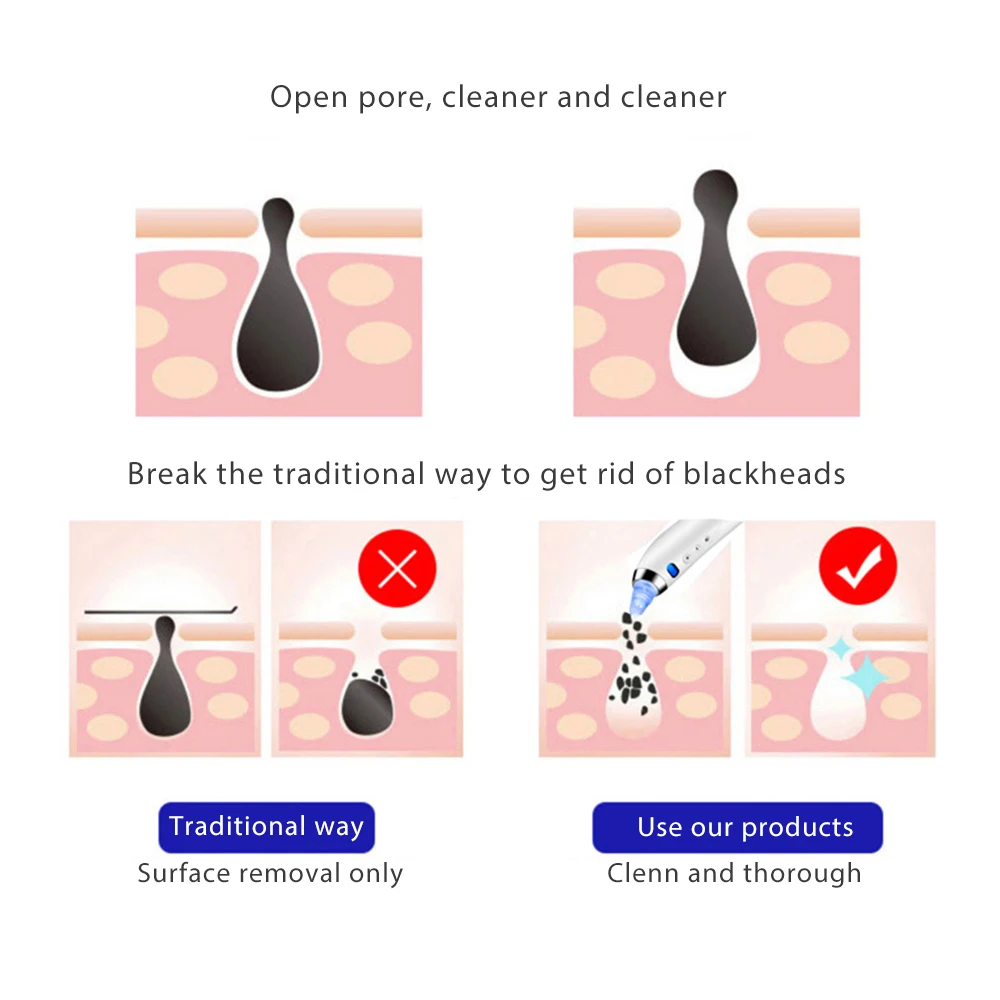 Лицо поры очищающее средство от черных точек для удаления прыщей вакуумное всасывание инструмент для удаления прыщей для акне черные точки вакуум для очистки лица очиститель