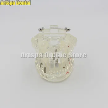 

Dental Implant Study Analysis Demonstration Teeth Model #2001 with Restoration Dental Material