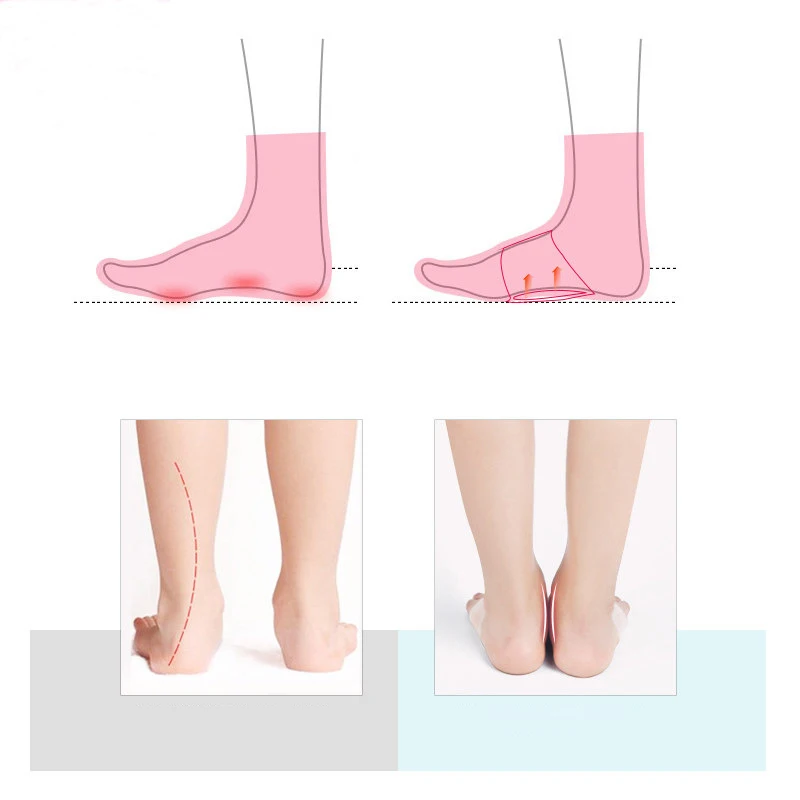 

Arch Support Foot Pad Flat Foot Support Socks Protection Foot Heart Care Cushion Foot Health Care