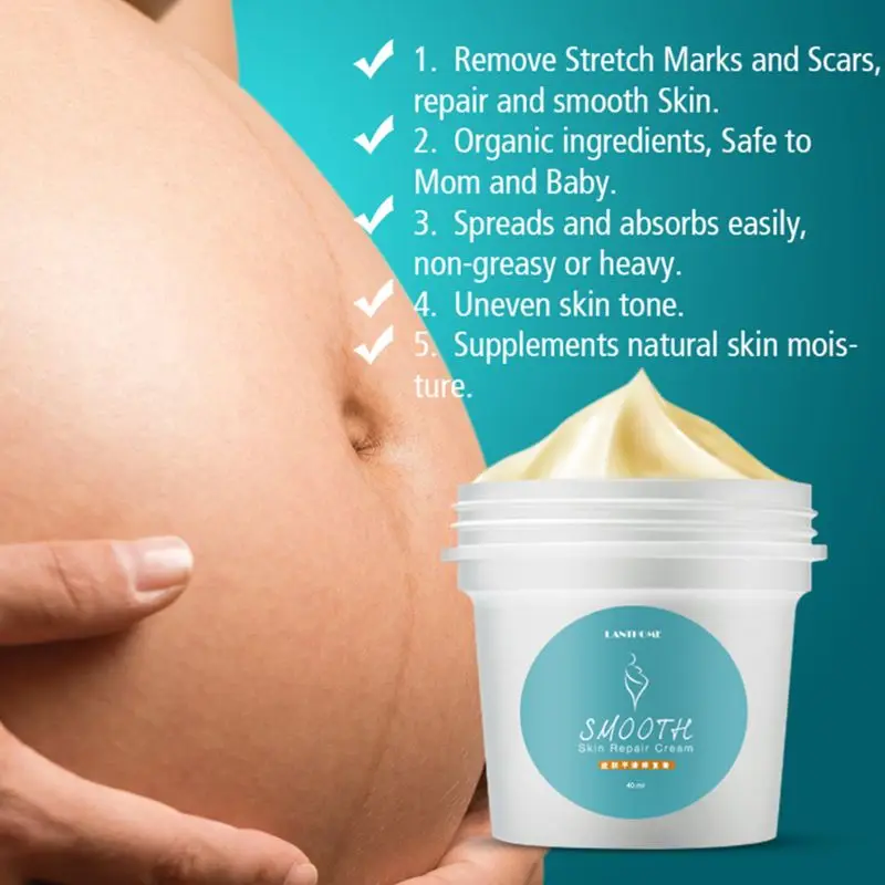 

40ML Pregnancy Scar Acne Removal Gel Smooth Skin Repair Cream Anti Stretch Marks Treatment Maternity Body Friming Lotion