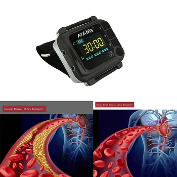 

Laser Physiotherapy 650nm Laser Light Wrist Diode Low Level Laser Therapy lllt for Diabetes Hypertension Diabetic Watch