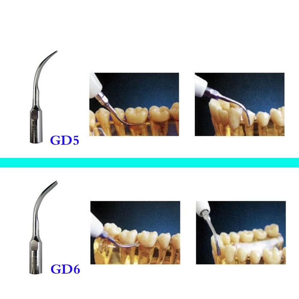 Скалер ультразвуковой uds-a, без принадлежностей, woodpecker, китай. Аппарат вектор скалер. Скалер uds-m. Инструкция на скалер maxpiezo7+ на русском. Насадка gd4 к скалеру dte/nsk/satelec, для удаления зубного камня.