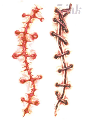 m04