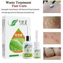 Hot Sell Professional Skin Tag Remover Natural Health Mole Nevus Wart Skin Tag Foot Corn Warts Treatment Real Skin Removal