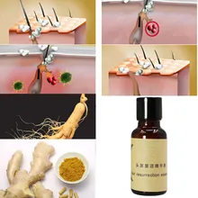 20 мл, эссенция для роста волос, жидкость для роста волос, против выпадения волос, питательные эссенции для ухода за волосами, 998