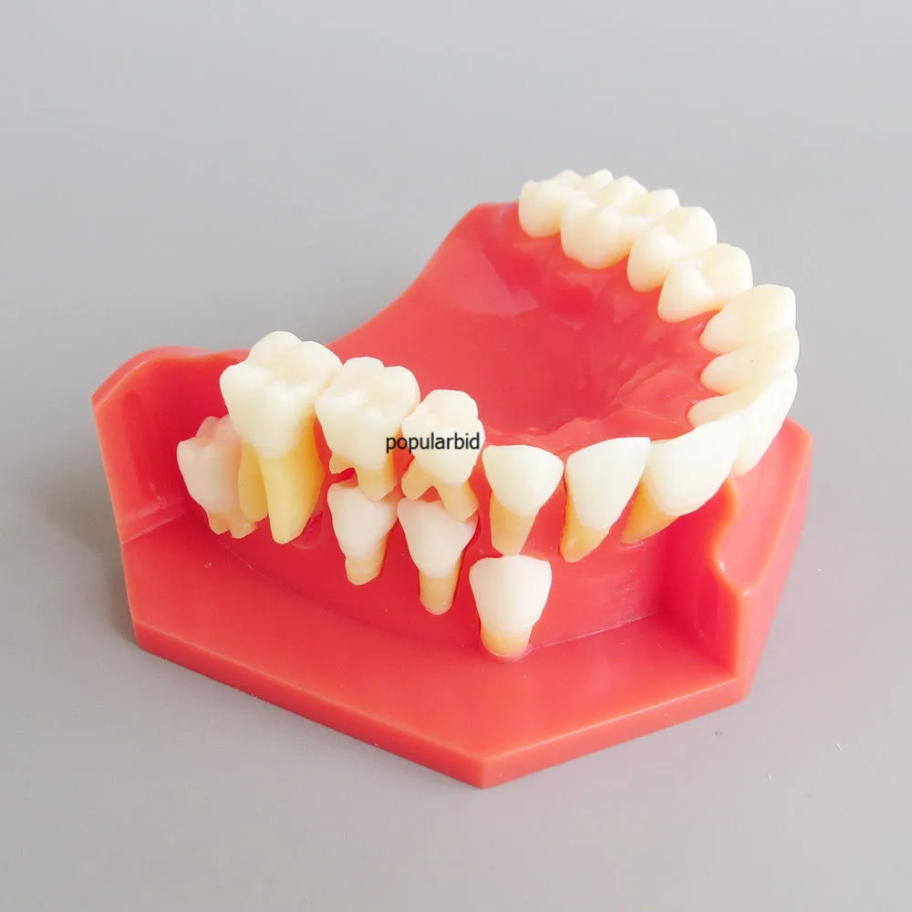 Альтернативная модель первичных зубов для детей 3-6 лет, показывающая извержение первичных и постоянных зубов