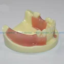 Хорошее качество Имплантат практика модель для обучения зубной зубы стоматолог анатомическая модель Анатомия odontologia