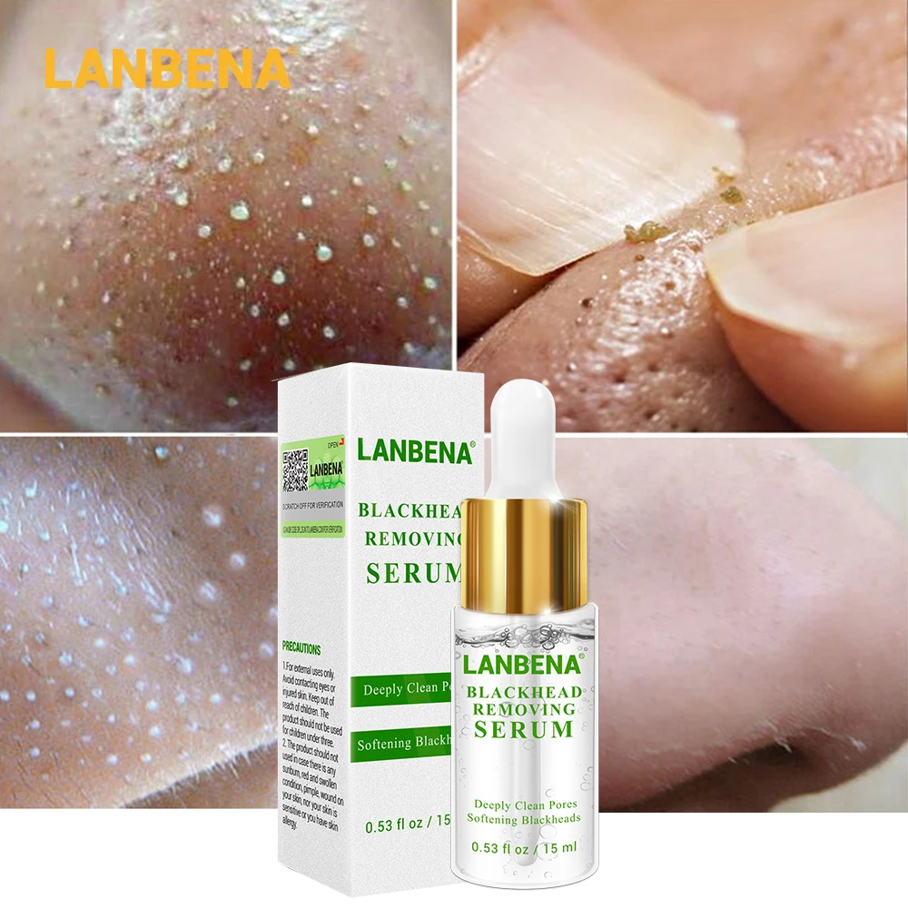 

LANBENA Blackhead Removing Serum Deep Pore Acne Pimple Gentle removal Acne Treatment Shrink Pores Purifying Skin Care 15ml