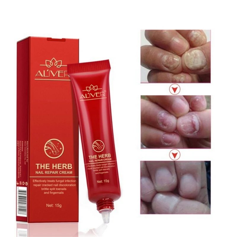 

15g Armor Essence Nail Treatment Essence Cream Nail and Foot Whitening Toe Nail Fungus Removal Nail Treatments