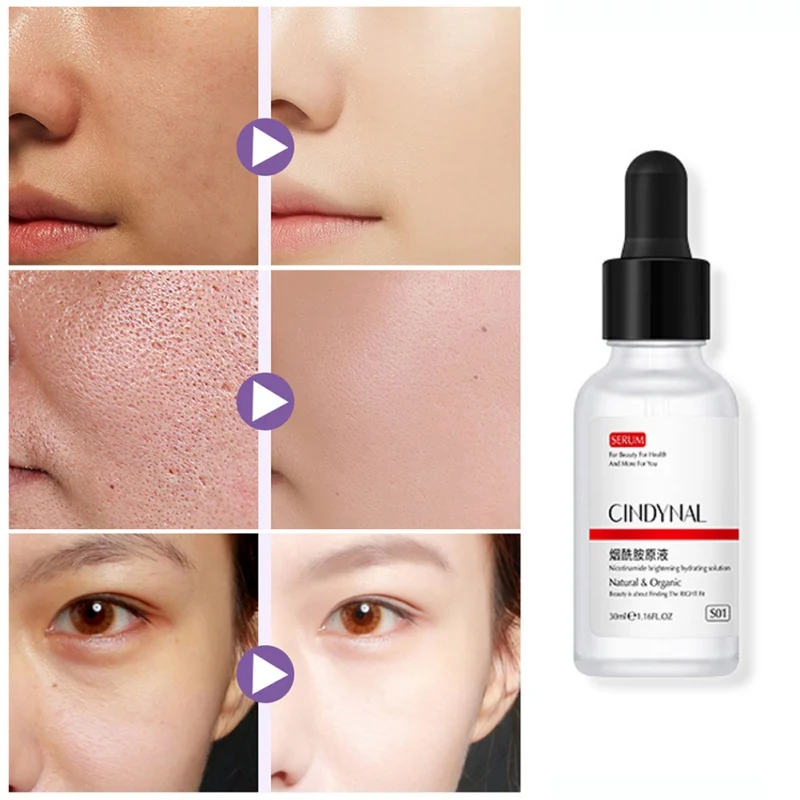30ml Nicotinamide Whitening Face Serum Brighten Skin Moisturizing Dark