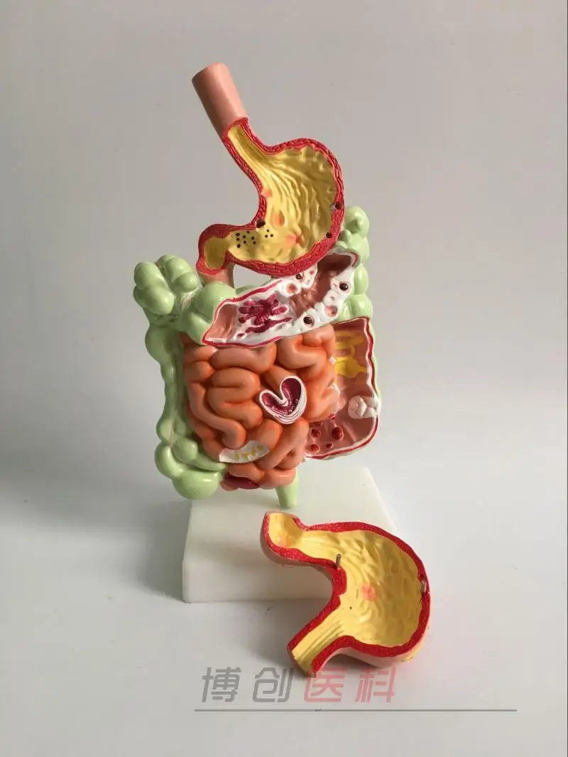 

Stomach Anatomy Model Large Intestine Cecum Rectal Medicine Human Digestive System Teaching Supplies