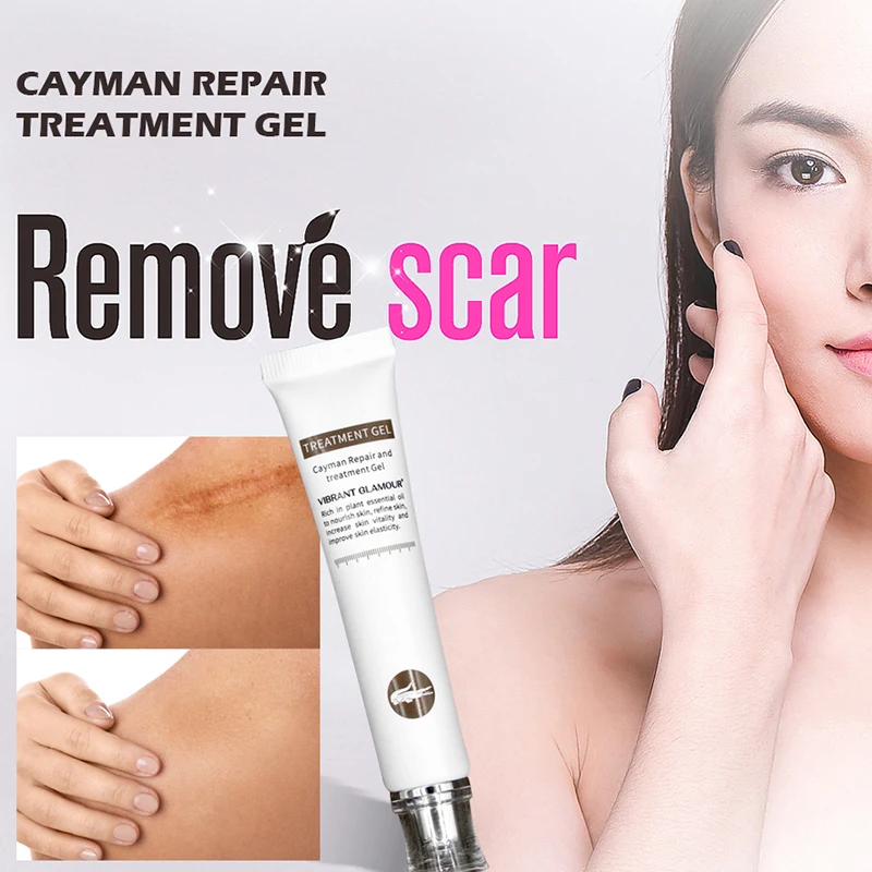 

Repair Scar Cream Removal Scars For Face Or Body Pigmentation Corrector Scalded Surgery Scar Insect Bites Mark !