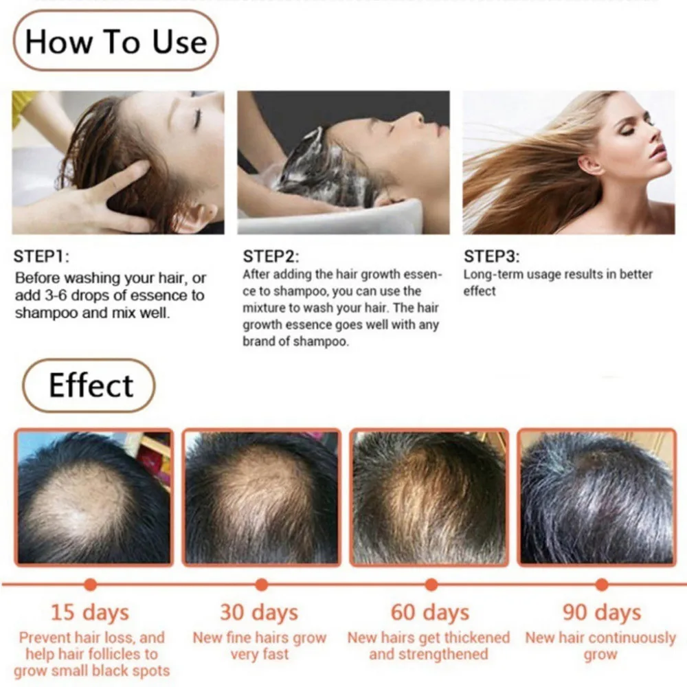 Сохранение имбирное эфирное масло ускоренный рост волос плотная отрастания Сыворотки противодействие Лечение Уход за волосами терапия