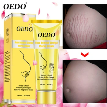 

Rose Remove Stretch Marks Cream Anti Aging Anti Wrinkle Maternity Skin Repair Remove Pregnancy Scars Treatment Skin Care 40g