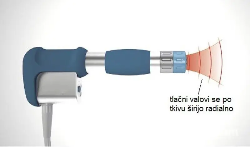 Горячая Распродажа рукоятки и головки для лечения для физиотерапии penumatic shockwave shock wave терапия машина для облегчения боли