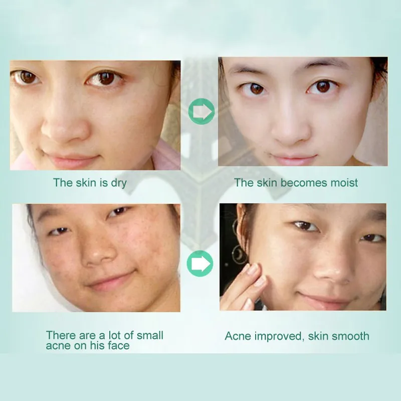 Карите масло корейская косметика секретный уход за кожей эссенция для лифтинга нежная Омолаживающая отбеливание морщин удаление крем с гиалуроновой кислотой Pro