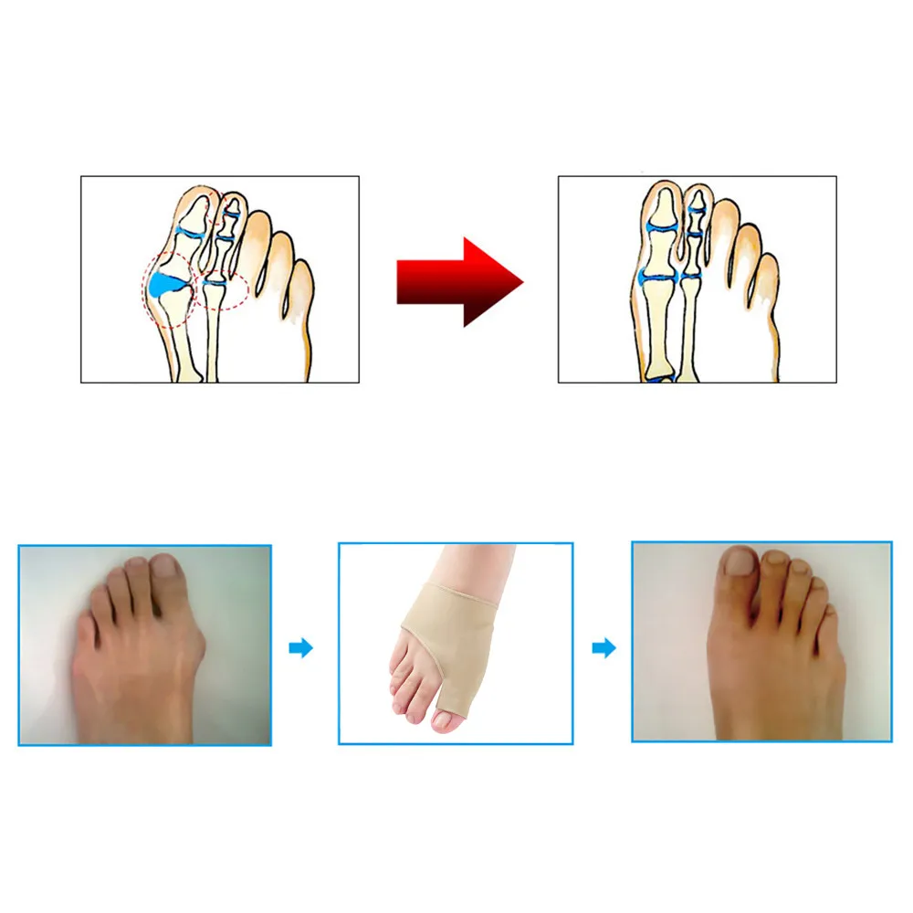 Дропшиппинг продукт Уход за ногами инструмент вальгусная Подушечка для пальцев ног Hallux рельеф корректирующая накладка протектор рукав Уход за ногами инструмент