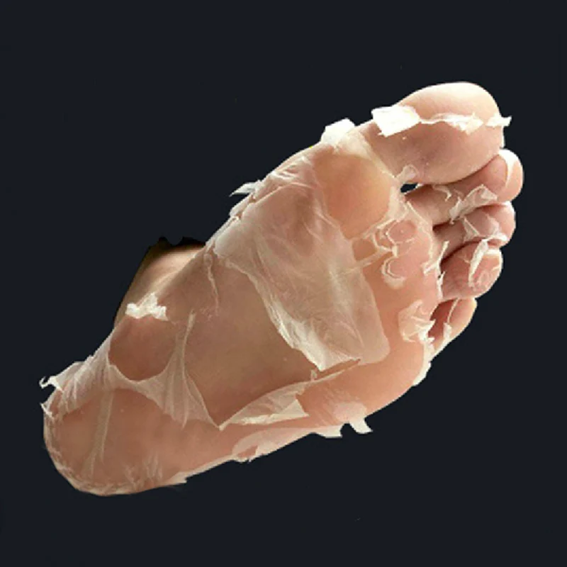 Bilderesultat for dead skin