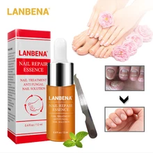 Высокое качество ногтей ног протектор крем для ухода за кожей Лечение грибка ногтей травы ногтей восстанавливающий крем по уходу за ногтями Инструменты