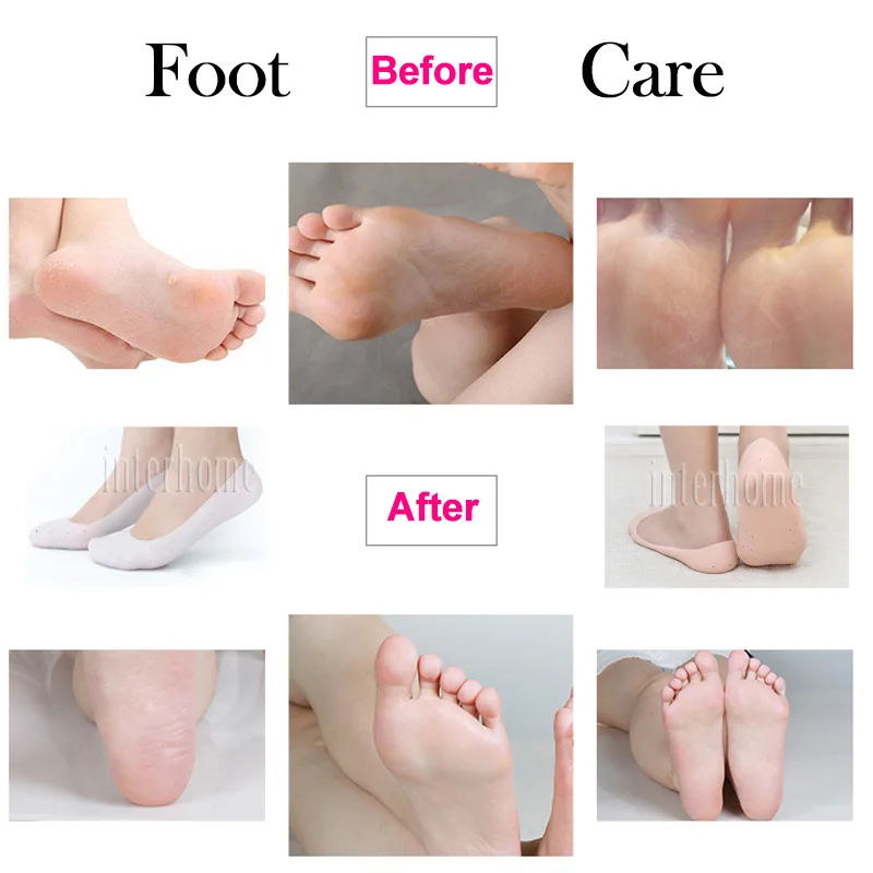 Gel-socks-PWZ030(8)