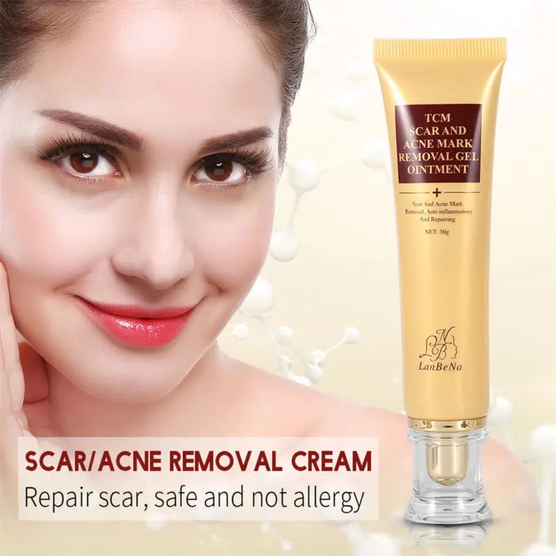 

Acne Scar Removal Cream Skin Repair Face Cream Acne Spots Acne Treatment Blackhead Whitening Cream Stretch Marks 30g TSLM2