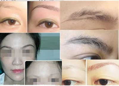 eyebrow growth effect