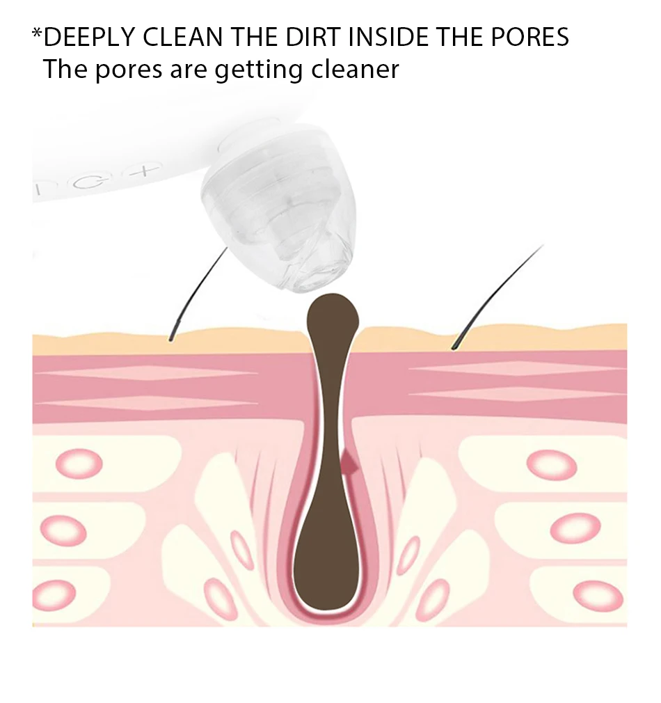 Removedor de Cravo para o Rosto Máquina de Sucção a Vácuo Ferramenta Cravo Acne Pimple Remover Extractor Pore Cleaner Limpeza Profunda Facial 18 Removedor de cravo para o Rosto Ferramenta