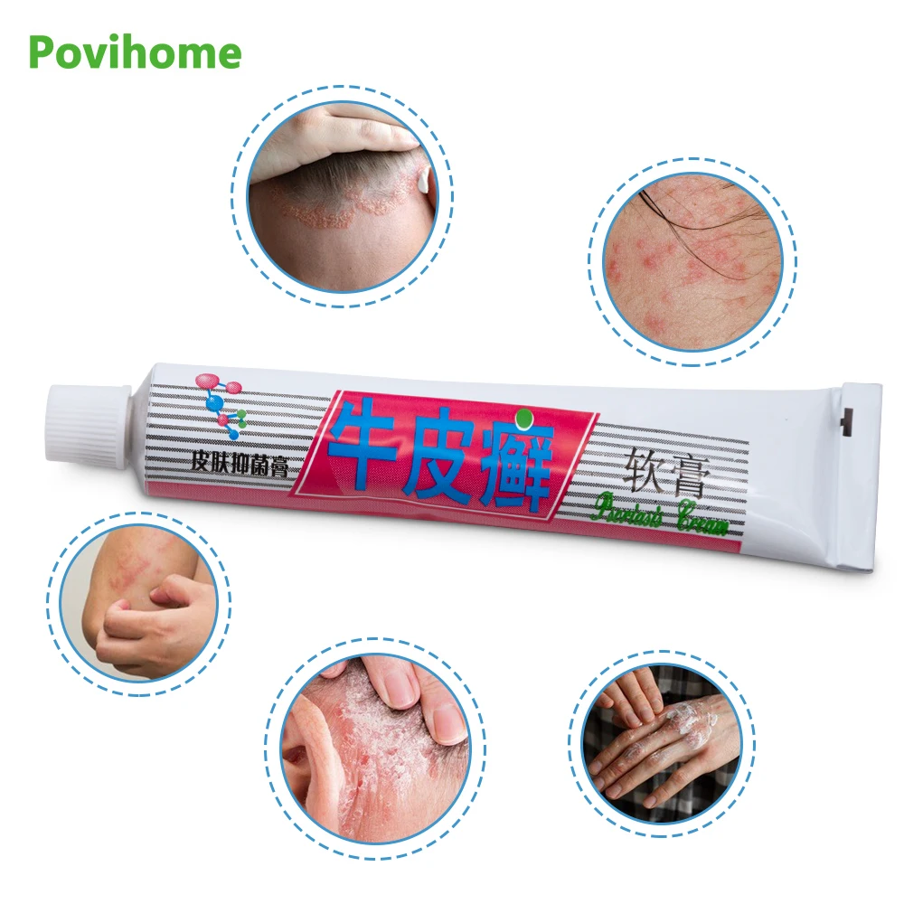

1pcs Psoriasis Creams Herbal Medical Plaster Eczema Pruritus Dermatitis Itching Pain Relief Ointment Skin Care P1017