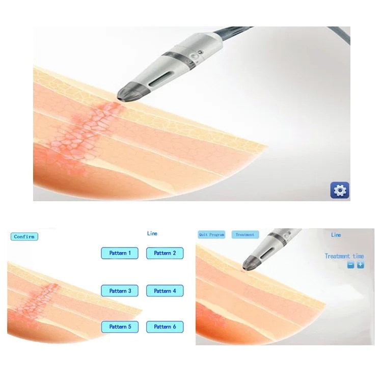 HTB1bi59lCMmBKNjSZTEq6ysKpXaF.jpg_ (1)