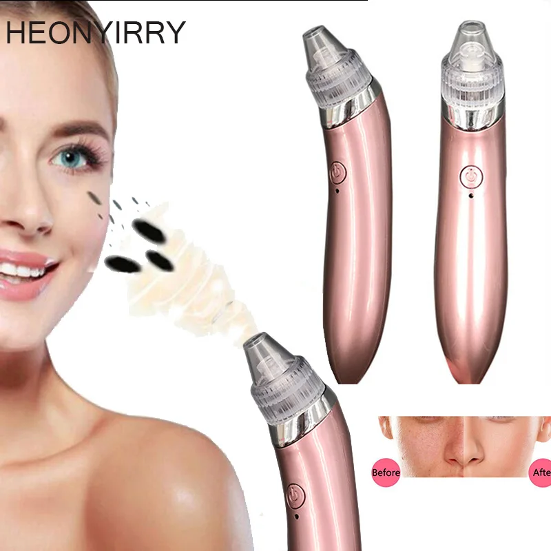 

Blackhead Vacuum Electric Pore Cleaner Acne Blackhead Remover Pore Vacuum Extraction USB Rechargeable Comedo Suction Beauty Tool