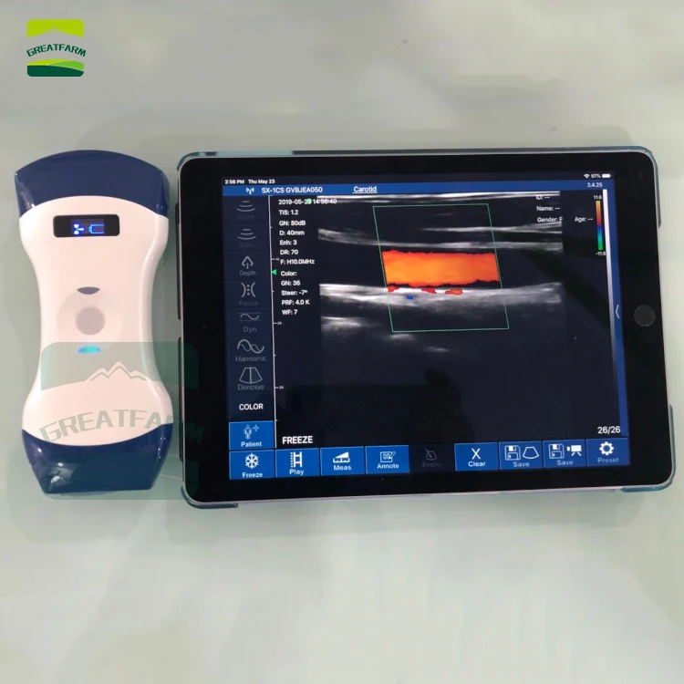 

PW color Double probe Wireless Veterinary Ultrasound Scanner Portable Pregnancy Test pig dog Hand Ultrasound Machine Pocket dog