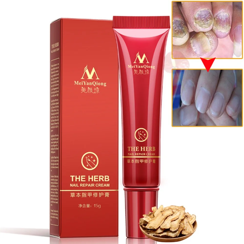 Promo Price for  Foot Nail Protector Skin Care Cream Nail Fungus Treatment Herb Nail Repair Cream