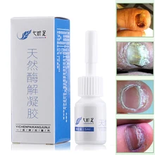 Жидкость для восстановления ногтей 5 мл травяная Лечение грибка для ногтей onychomicosis Paronychia против грибковой инфекции ногтей Защита ног