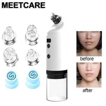 

Electric Facial Pore Cleaner Home Small Bubble Acne Horn Sebum Blackhead Remover Vacuum Suction Pore Deep Cleaning Beauty Face