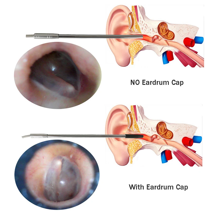 HD визуальная Ушная ложка, очиститель для ушей, эндоскоп с 4,9 мм линзой, инструмент для удаления воска ушей, многофункциональная барабанная перепонка, проверка здоровья, инструмент