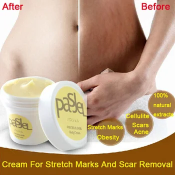 Cream For Stretch Marks And Scar Removal Powerful To Stretch Marks Maternity Body Repair Cream Remove Scar Care Postpartum RP1-5