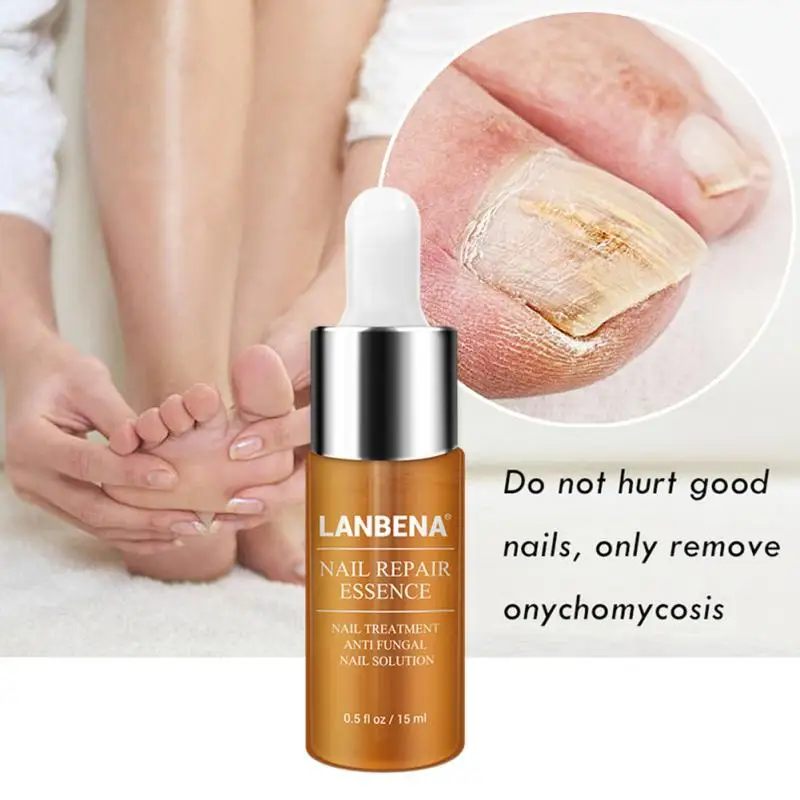 Защита ноги эфирное масло для ухода за кожей сыворотка удаление грибка здоровый ремонт эссенция для ногтей Лечение инструменты для ухода
