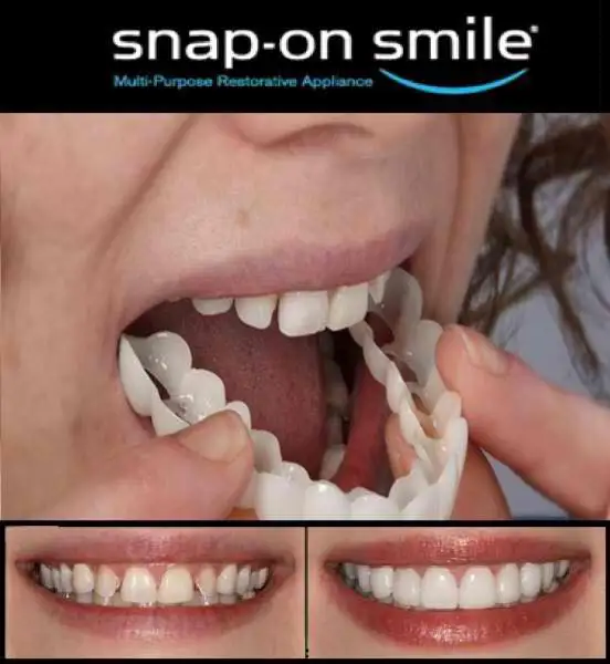 Косметическая стоматология Snap On Smile Instant Smile комфорт Fit Flex косметические зубы один размер подходит для наиболее комфортного ухода за