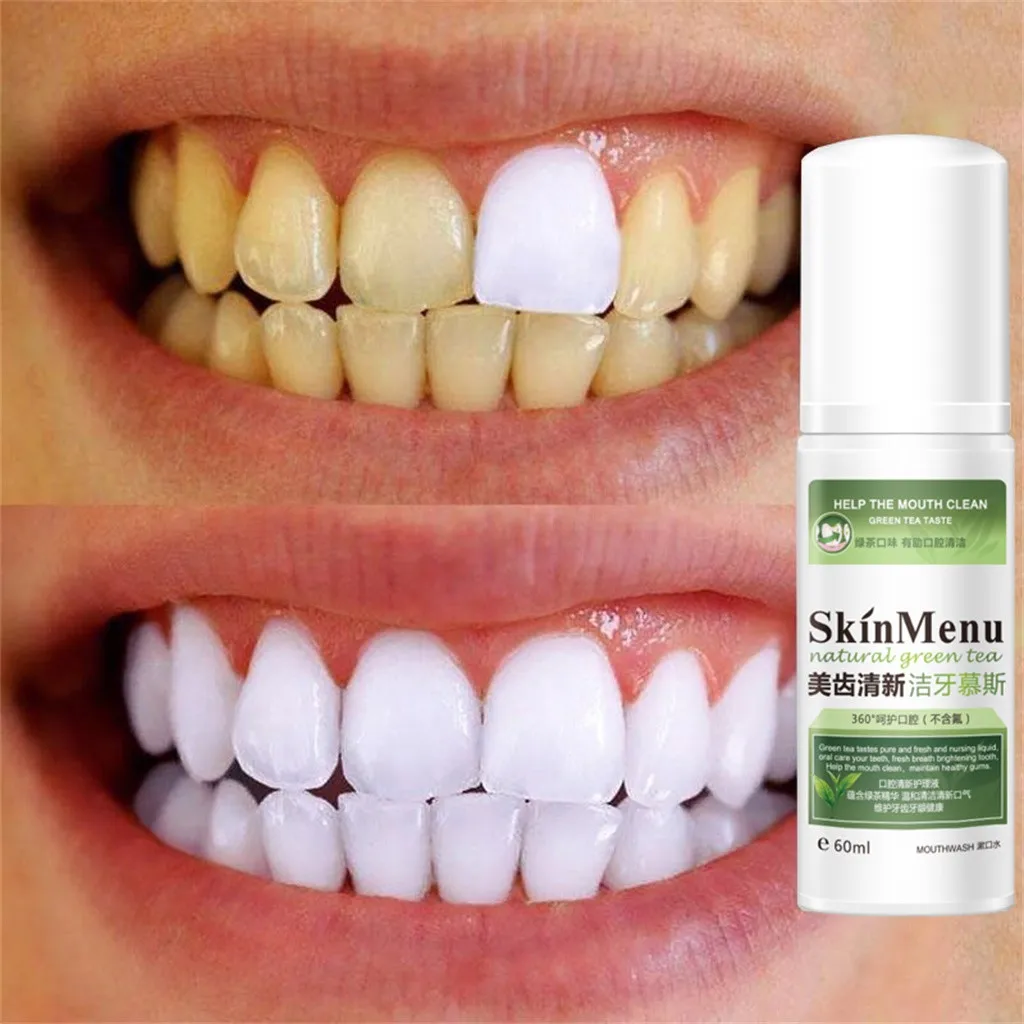 Pure Natural Remove Stain Yellow Teeth White Tooth Cleaning Oral Mouth