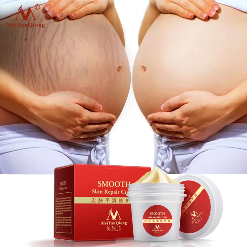 

Smooth Skin Stretch Mark Skin Cream Removes Maternal Skin Repair Body Cream Removes Postpartum Scar Care Gentle Moisturizing